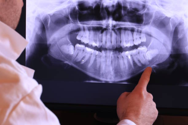 Best Emergency Treatment for Oral Infections in Mays Chapel, MD
